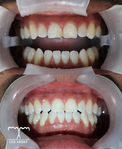 Odontología Los Andes