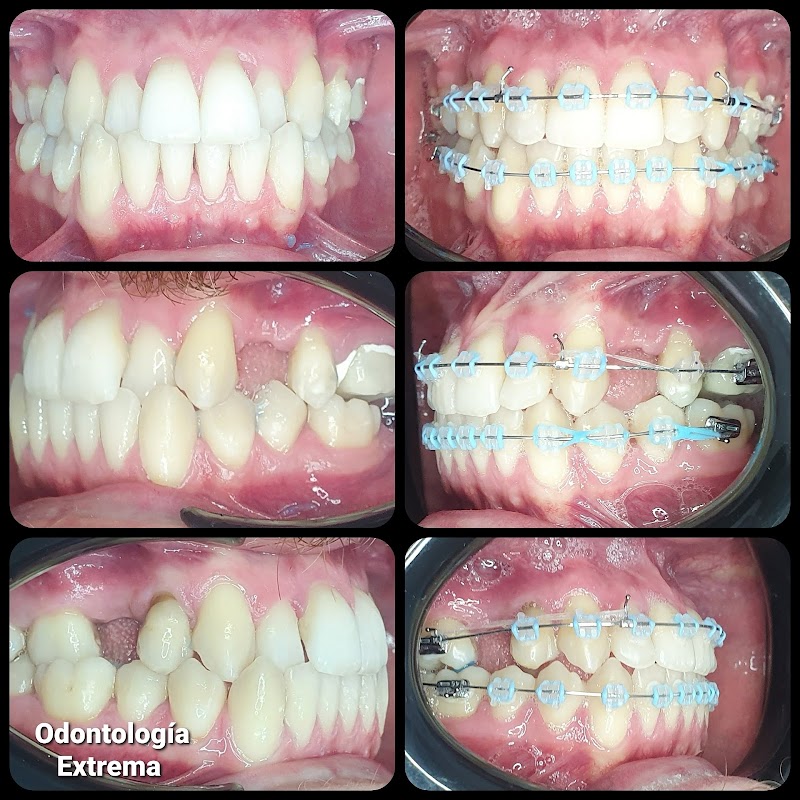 Unidad de Odontología Extrema