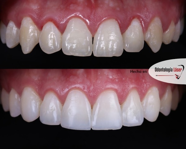 ARTEK ODONTOLOGIA LASER - ODONTOLOGIA COMFORTABLE - ORTODONCIA