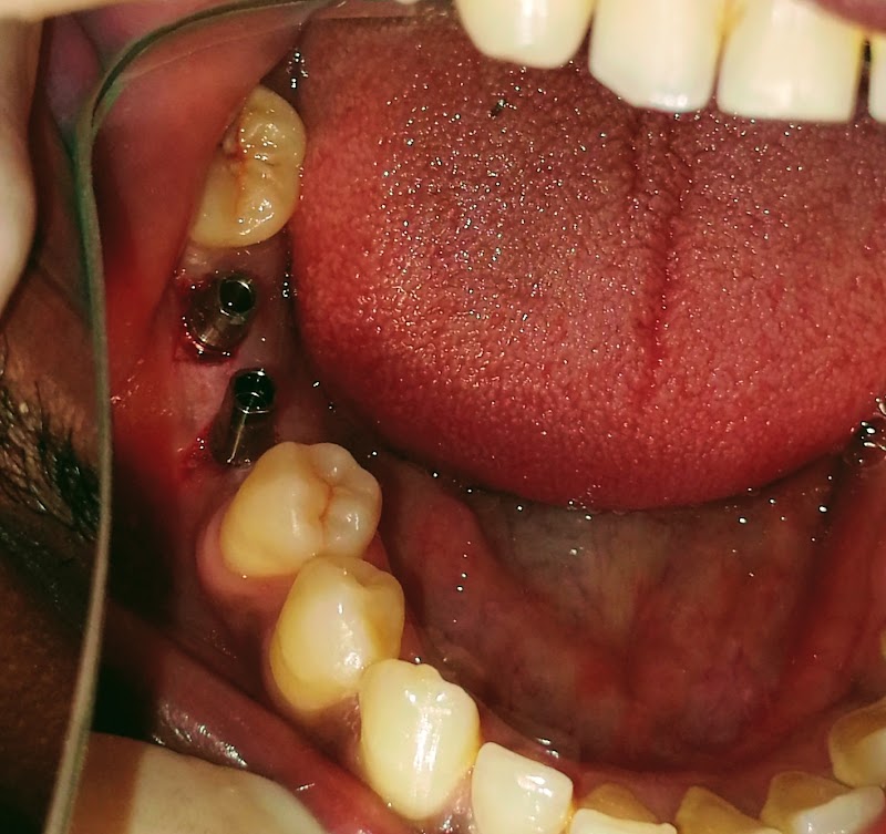 URGENCIAS ODONTOLOGICAS, MEDELLÍN