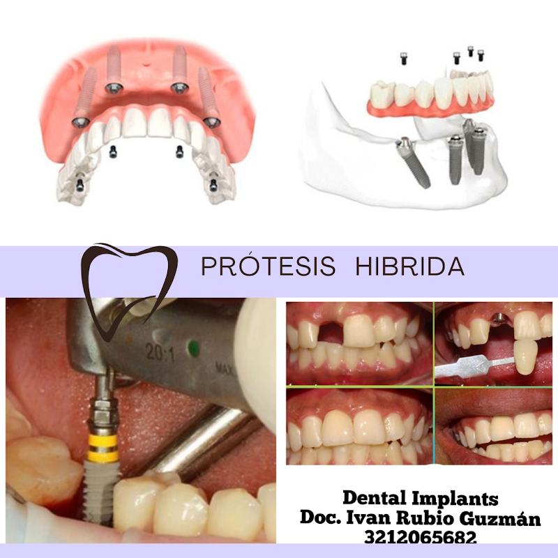 Consultorio Odontologico Dental Implants Dc. Rubio Guzman
