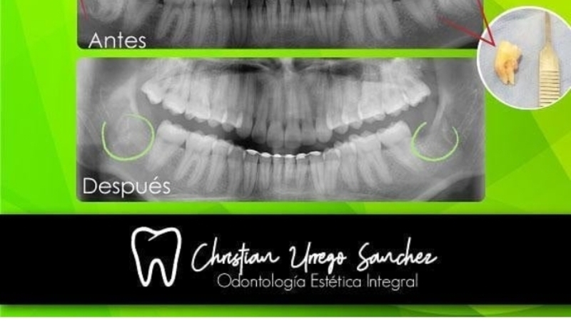 Christian Urrego Odontología