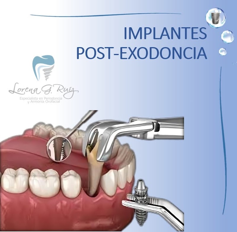 Odontología Dra. Lorena G. Ruiz
