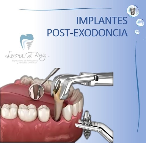 Odontología Dra. Lorena G. Ruiz