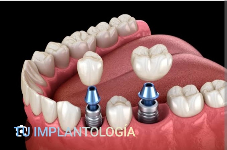ODONTOLOGÍA ESTÉTICA URGENCIAS 24/7 NO EPS.