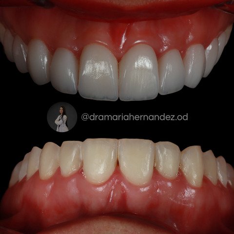 Odontología barranquilla / doctora María Hernández Odontología Estética, integral y Armonización Orofacial