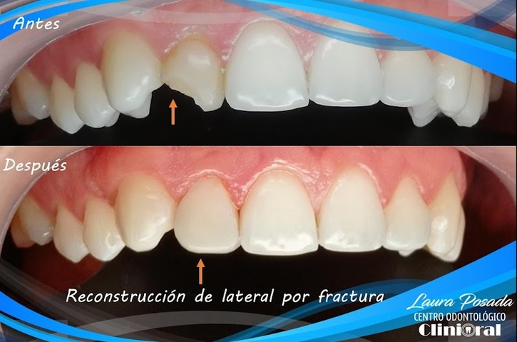 Centro Odontológico Clinioral Santa Marta