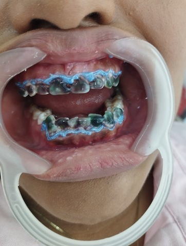 Consultorio odontológico dra. juliette ospino