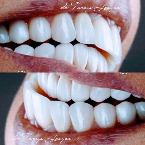 Sonrisa Perfecta Dental - Tarsys Loayza Roys