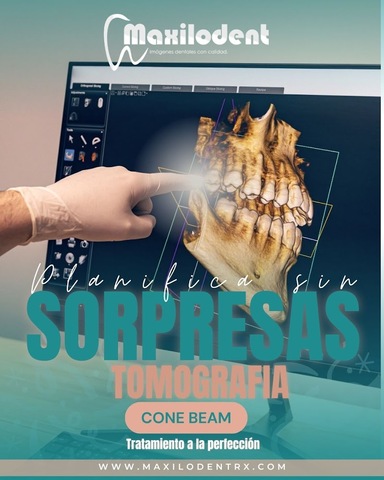 Maxilodent 3D