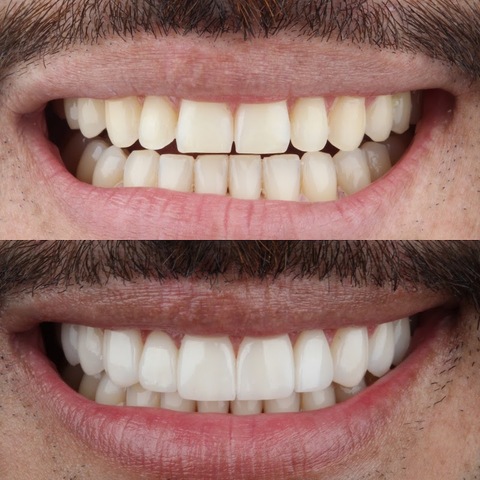 Dra. Kelly Gonzalez / Odontología Estética / Diseños de Sonrisa